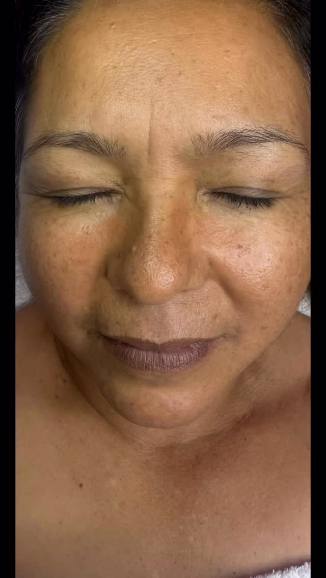 #Customized facial ✨ her skin was dehydrated her skin needed love 💖