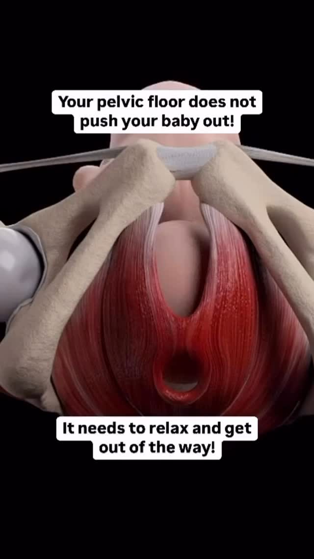 I love this visual from @balanced.birth.couple
•
You don’t need a strong 💪🏼 pelvic floor to push your baby out.
(Your uterus does most of the work!)
You need a relaxed pelvic floor that’s responsive (instead of tense).
Tense pelvic floor = harder time pushing
Combine this with hospital pushing practices like pushing on your back and pushing can become harder than it needs to be.
To push most efficiently and avoid tearing, you need to learn how to relax your pelvic floor and push in whatever position feels best to you (bc your body knows best usually).
Want to learn more about how to advocate for this in the hospital?
Take our FREE class - 4 Secrets to Unmedicated Hospital Birth
Comment #secrets to sign up!