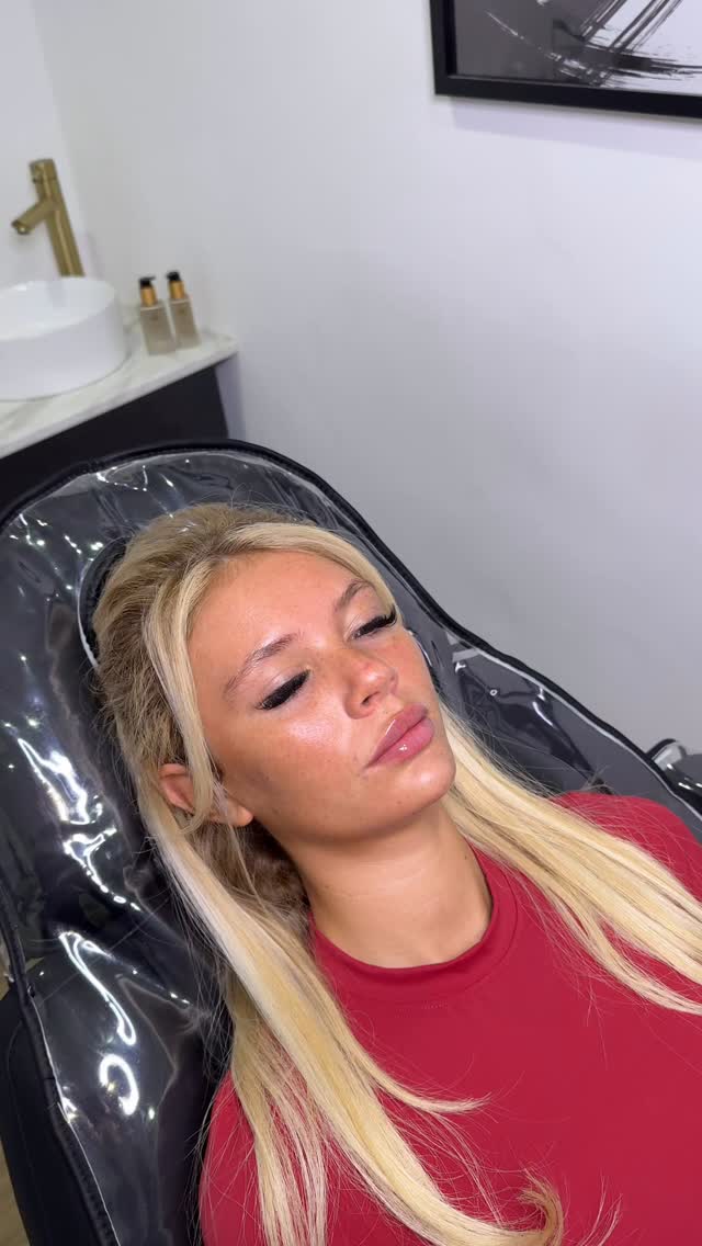 Lip and chin maintenance for our beautiful girl Lillie ❤️
This combination is just 👩🏼🍳💋