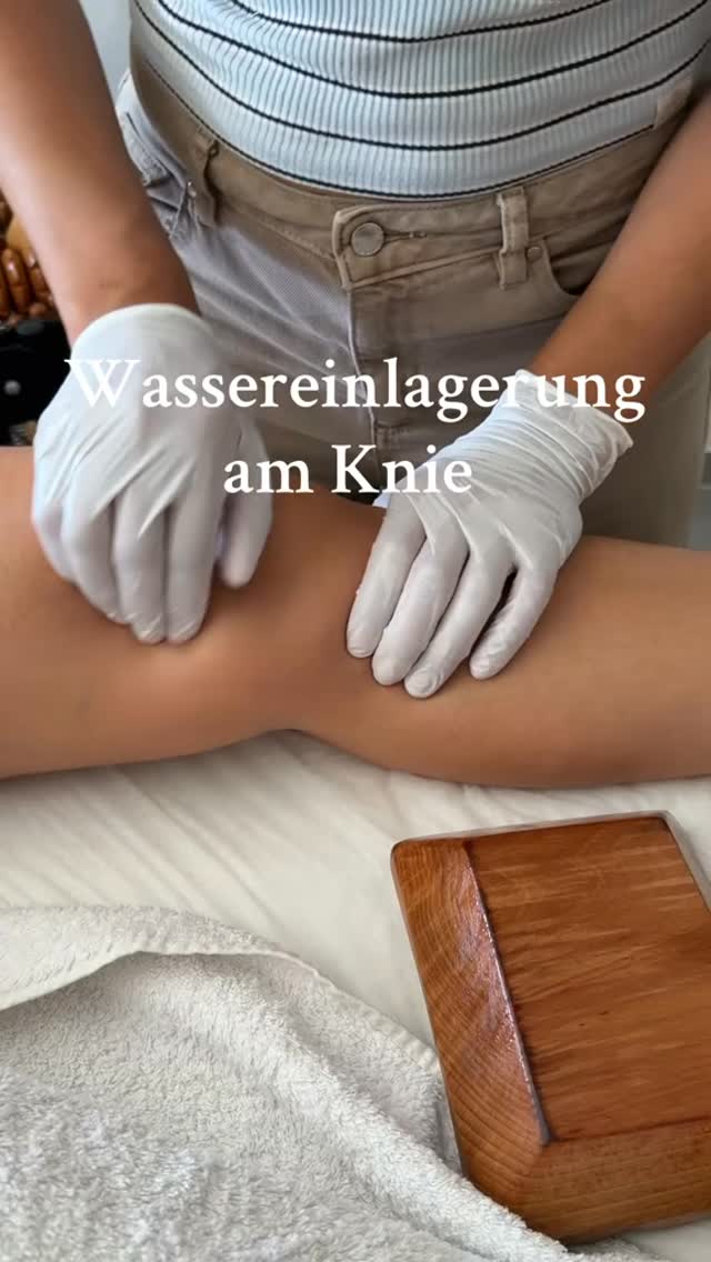 Wassereinlagerung am Knie /Ursachen, Symptome & Behandlung
Eine Wassereinlagerung am Knie, auch Gelenkerguss genannt, entsteht, wenn sich Flüssigkeit im oder um das Kniegelenk ansammelt. Das betroffene Knie wirkt oft geschwollen, gespannt und ist beim Bewegen schmerzhaft. Manche Menschen spüren auch Wärme oder Druck im Knie.
Ursachen können sein:
• Eine Verletzung (z. B. Bänderriss oder Meniskusschaden)
• Eine Überbelastung durch Sport oder Arbeit
• Arthrose oder entzündliche Erkrankungen wie Rheuma
• Eine Infektion im Gelenk
Was hilft dagegen?
• Kühlen (z. B. mit einem Kühlpack)
• Hochlagern des Beines
• Schonung, aber leichte Bewegung, um das Gelenk beweglich zu halten
• Bei anhaltenden Beschwerden: ärztliche Untersuchung
In manchen Fällen wird die Flüssigkeit vom Arzt mit einer Nadel abgesaugt oder Medikamente verordnet. Auch Lymphdrainage, sanfte Massagen oder spezielle Therapien wie die Madero-Therapie können unterstützend wirken.
#maderotherapie #münchen #lipödem #madero #wassereinlagerungen #umfangreduktion #massage #knie