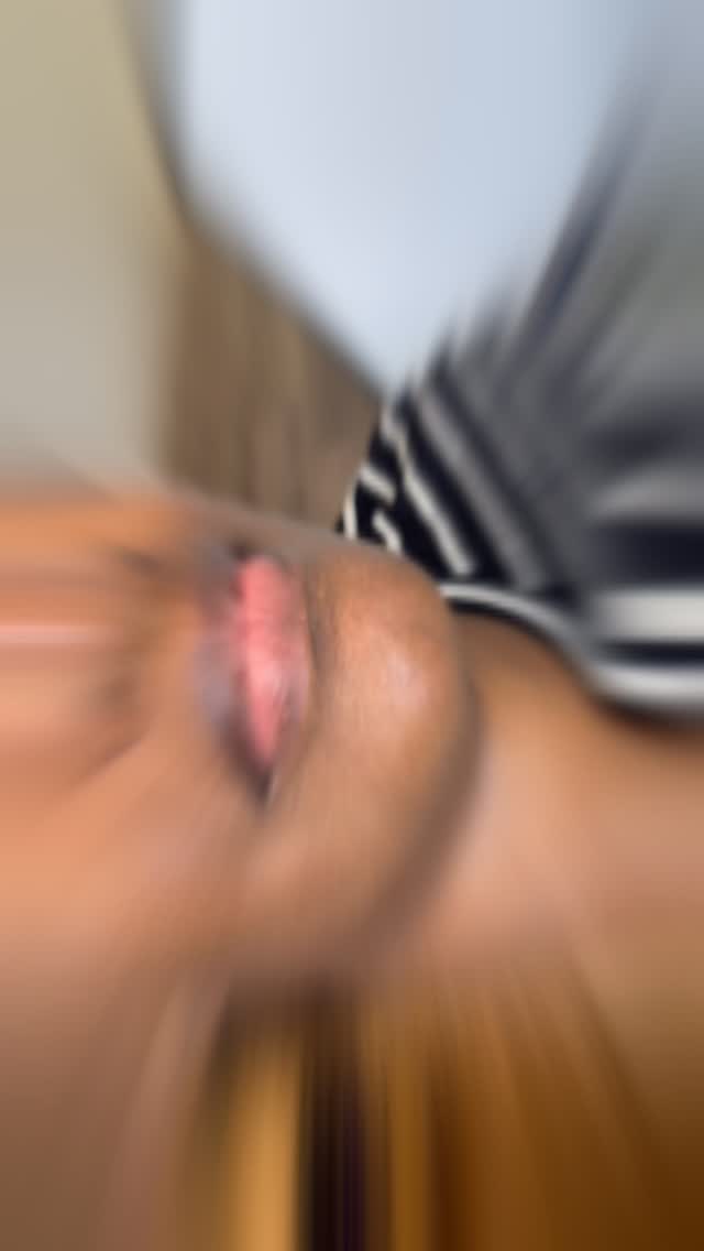 LIP NEUTRALIZATION FOR THE WIN 🏆
This is a cosmetic procedure that corrects dark or cool undertones in the lips, aiming to create a more even and balanced lip color. It’s a semi-permanent makeup technique where we will layer ink pigments to brighten and enhance lip tone, particularly for those with naturally darker lips or uneven pigmentation.
It is a customized approach using color theory to correct undertones, improve dark lips, enhance the lip color and restore confidence. There is temporary swelling post treatment that will subside. MULTIPLE sessions are needed (2-4) for optimal results. The results of lip neutralization can last for several years, with touch-ups needed to maintain the color and shape over time.
Inquiries and Consultations are available prior to book an appointment.
Enhancing Lives One Image At A Time™️
BEAT & BLADE
📍Houston, TX
(832) 377-5677
info@beatandblade.com
www.beatandblade.com
#liptattoo #lipneutralization #lipneutralizationtraining #darklips #beforeandafter #lipfillers #liptransformation #lipgloss #lips #lipstick #pmulips