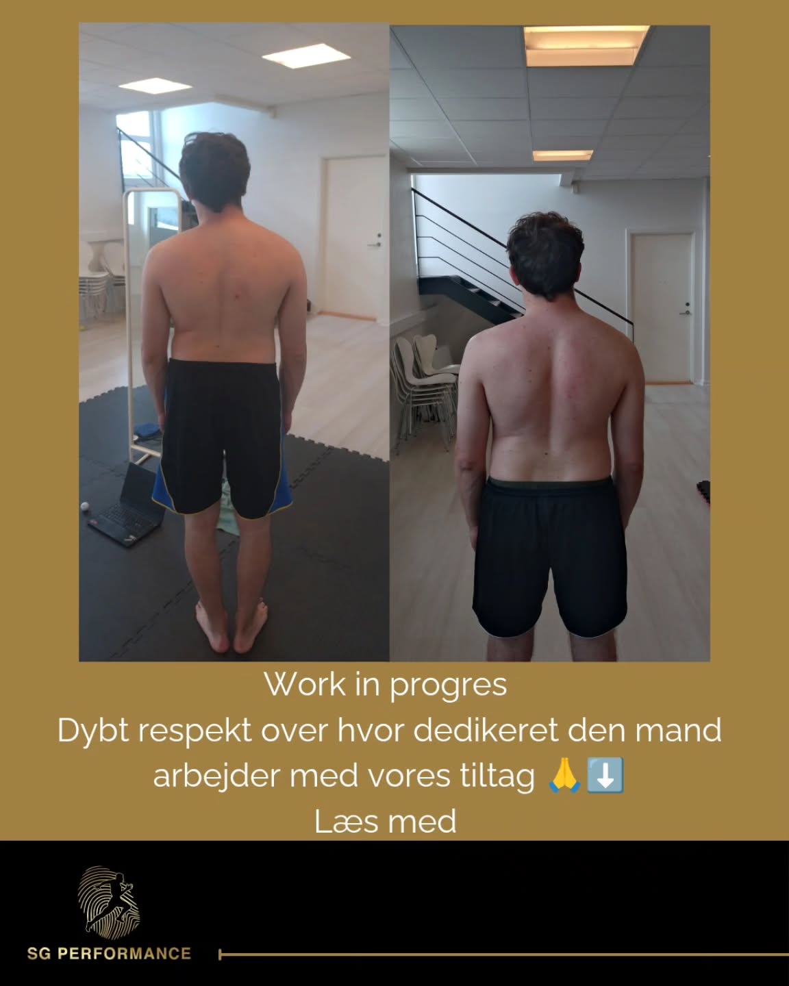 Som skrevet jeg er imponeret, taknemmelig og glad for at jeg må være en del af processen! Super givende at kunne hjælpe, og arbejde mennesker som tager ansvar for deres helbred 🙏👑
Tak !
Hvad vi har gjort ?
Vi har selvfølgelig startede med grundige test:
-Posturale
-Biomekanisk
-Gennemgang af røntgenbilleder
-Gangfunktion + Løb
-Talt om egen opfattelsen
-Hvordan vejrtrækning kan forandre og skabe
-Indvirkning af nervesystemet
-Stabiliserings mekanismer
-Styringssystemer
Jeg har udarbejdet en meget individuel plan, som er tilpasset 100% hans struktur samt spændings mønstre.
Der er nogle enkelte hjemmeøvelser, så arbejder vi sammen hvor vi bruger noget mere avancerede tekniker, og har der sjovt 😁👌
Hvor lang tid vi har brugt indtil videre ? 🤔
3 x sessioner ✔️
Der kommer meget mere !
Jeg kan nogle gange være så træt af at mennesker får at vide de ikke kan gøre noget ved deres situation !
For rigitg ofte kan der skabes en kæmpe forandring.
Når man ved hvordan man gøre det.
Vi har på så kort tid skabt, en kæmpe forandring i hans liv.
Har du brug for hjælp eller, en mening om din situation. Så sig endelig til 😊
#biomekanik #biofeedback #skoliose #vejrtrækning #nervesystemet #viralreels #balance #performance #rotation #bevægelse #tanker #muskelkæder