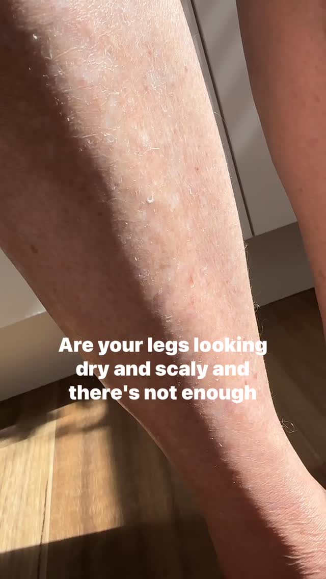 🐊If your legs feel dry and scaly even after you moisturise? This 3-step after-shower routine is for you. 💦✨
This has been my go-to routine to keep my body skin soft, smooth, and glowing all year round, especially during cooler months when dry skin hits hard. Here’s what I do:
1️⃣ Gentle exfoliation (African net sponge ftw!)
2️⃣ Apply body oil while skin is still damp then pat dry.
3️⃣ Seal it in with a nourishing body lotion/moisturiser or body butter.
It’s simple but so effective—no more crocodile legs 🐊
Have you tried an after-shower routine like this? Save this for your next shower and thank me later. 😉
#bodycareroutine #hawthornebeautysalon #aftershowerroutine #glowingskin #dryskin #selfcare #skincaretips