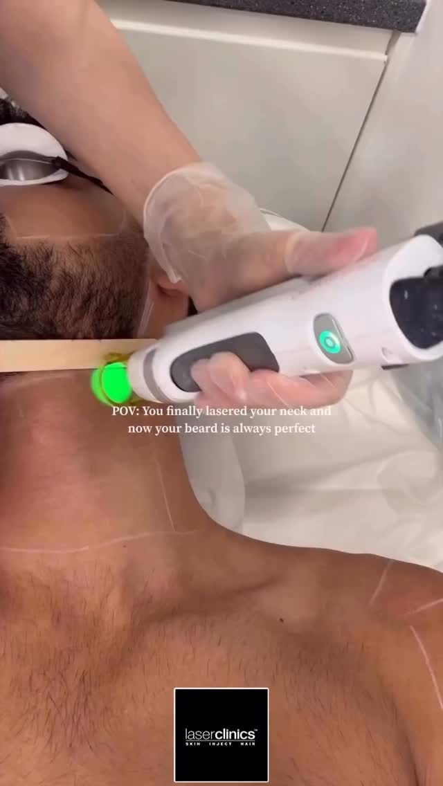 Not just for the ladies...
Are you tired of constant shaving, razor bump or annoying stray hairs? We’ve got you covered.
Mens laser hair removal facial areas:
- Full beard area
- Middle brow
- Ears
- Top of the cheek
- Neck
- Back of the neck
Less shaving, smoother skin, more confidence, less upkeep!
Using Candela Alexandrite 755nm laser- clinically proven to work best on pale skin and dark coarse hair - we target unwanted hair with precision and long lasting results
✨ Free consultation and patch test ✨
No obligation - just expect advise and a custom plan
DM us to book your free consultation today
REPOST @laserclinicsuk Posted by @candelamedicaluk
#laserclinicsuk #gentlelaser #laserhairremoval #notjustfortheladies