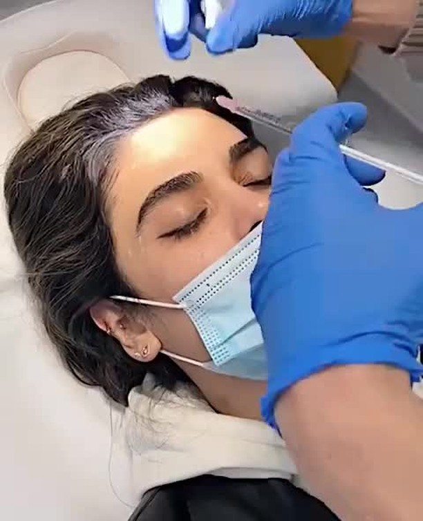 Upper face Botox injections for a smoother, fresher look 😍
Quick, non-invasive, and minimal downtime for this Botox treatment! Botox starts at £300 💫
Call 07901206846 or email contact@drmendelovici to book your treatment 🙏🏼