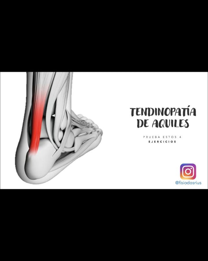 En el siguiente video encontrarás un conjunto de ejercicios básicos, fáciles de realizar, que no requieren de material en especial y que te ayudarán a mejorar tu "tendinitis" del tendón de Aquiles.
✅ En este caso se trata de ejercicios isometricos que estarán aconsejados sobretodo en las fases más iniciales y que buscarán ayudarnos a mejorar nuestro dolor.
📝 La prescripción recomendada de estos ejercicios en este tipo de patología es de 5 series de 1 repetición de 45 segundos. Si es muy exigente para ti y no eres capaz de realizarlo, reduce el tiempo inicialmente y poco a poco aumentarás según tolerancia.
#fisioterapia #rehabilitación #tendinopatia #tendinitis #aquiles #tendondeaquiles #ejercicio #trabajo #fuerza #dolor #isometric #isometricos #fisioterapiadeportiva #deporte #traumatologia #trabajodefuerza