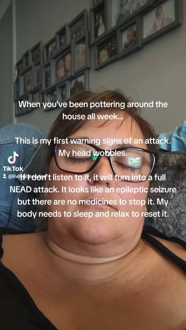 When you've been pottering around the house all week...
This is my first warning signs of an attack. My head wobbles.
If I don't listen to it, it will turn into a full NEAD attack. It looks like an epileptic seizure but there are no medicines to stop it. My body needs to sleep and relax to reset it.
FND is always there behind the scenes ready to pop up and say"too much, now you must rest!"
Are you fed up of having limitations that are out of your control? I am. But this is part of life now.
#Neurodivergent #AutisticADHDer #Autistic #AutisticAdult #LateDiagnosis #BreastCancerSurvivor #ChronicIllness #RealLifeStories #LivingDecoded #fnd #nead #fndawareness