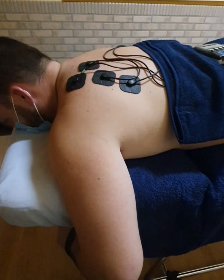POR QUÉ UTILIZAR ELECTROESTIMULACIÓN EN LA REHABILITACIÓN DE UN PACIENTE ⁉️
Muchas son las dudas que te pueden surgir si acudes al fisio y te plantea un tratamiento que no era el que te esperabas. Tal vez, pensabas que la sesión se iba a limitar a recibir un masaje o a que te pongan calor. Sin embargo, ¡sorpresa! Resulta que te ha hecho hacer algunos ejercicios y para colmo te ha puesto un aparato raro que da calambre.
Pues bien, ese aparato podría ser un electroestimulador. Para que nos entendamos, un bicho que suelta corriente y te hace que notes el músculo más duro mientras haces el ejercicio.
Pero, ¿por qué ha decidido hacer eso? 🤔
En mi caso particular, suelo utilizar este tipo de tecnología cuando sé que el paciente, a causa de una lesión previa o no, no sabe realizar el movimiento que le proponemos correctamente. Es decir, la uso como un apoyo externo, un feedback en forma de electricidad que te va a ayudar a notar los músculos o la zona que quiero que muevas y de una forma bastante "explicativa" 🤣.
Entonces, en resumen, ¿para que nos puede servir este aparato?
✅ Ayudar al paciente a activar mejor los músculos y darle un feedback de movimiento
✅ Potenciar la activación muscular que se puede haber perdido por una lesión previa
✅ Ganar más masa muscular, siempre que lo acompañes de un plan de ejercicio adecuado
✅ Disminuir el dolor
Si te ha quedado alguna duda pendiente de resolver al respecto, te invito a que me la preguntes, ¡te ayudaré encantado!📥
#fisiodosrius #fisioterapia #electroestimulacion #rehabilitación #controlmotor #atrofia #musculo #fisio #dolor #recuperacion #movimiento #fuerza #compex