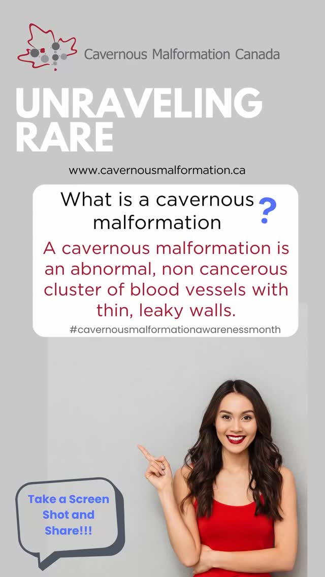 Unraveling Rare-Cavernous Malformation
démêler une malformation caverneuse rare
Learn more at www.cavernousmalformation.ca
#cavernousmalformation #cavernoma #raredisease #cavernomaawareness #cavernousmalformationawarenessmonth #stroke #inherited #cm #awareness