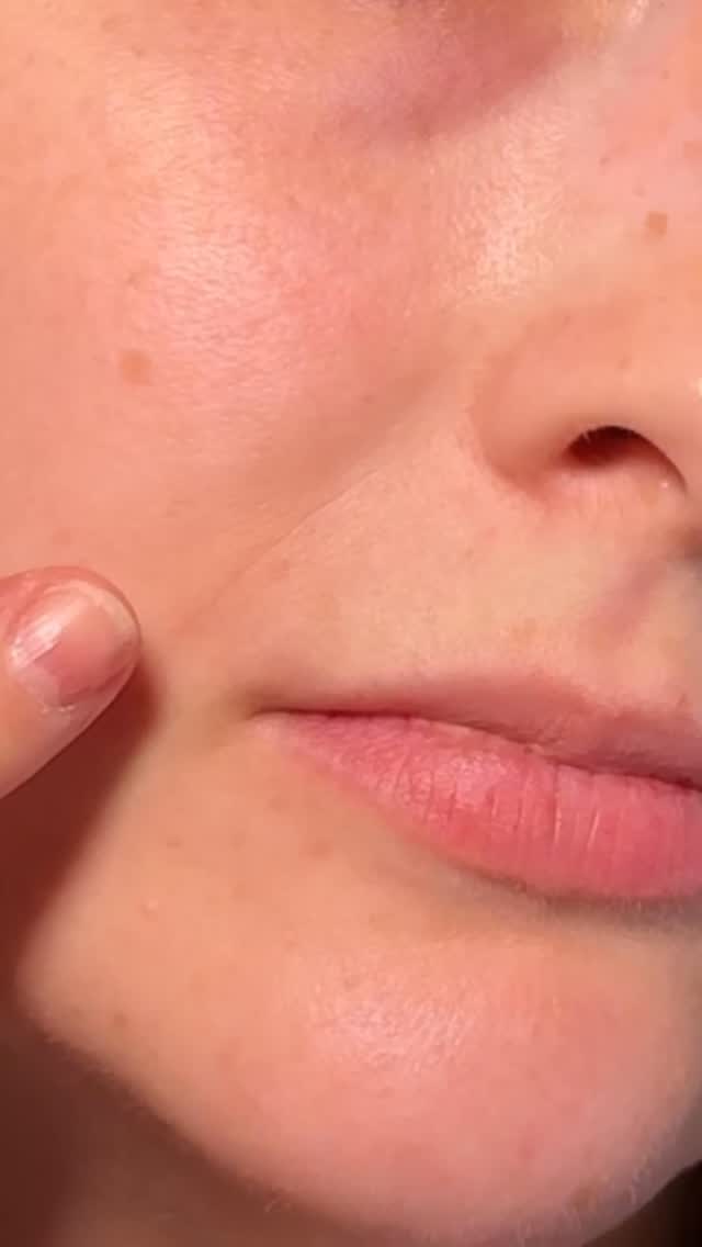 I’m all about preventative skincare as I head into my mid-thirties (WHAT?!) and the new @dermelect Smooth Upper Lip & Perioral Anti-Aging Treatment is exactly what the doctor ordered! With a multi-peptide complex and an amazing cooling applicator, I’m convinced it helps my lips look more plump, hydrated, and keeps my lipstick from feathering. Thank you @dermelect and @fromthelobby!
#ugc #ugccontentcreator #ugcportfolio #ugcexample #beautyugc #skincareugc