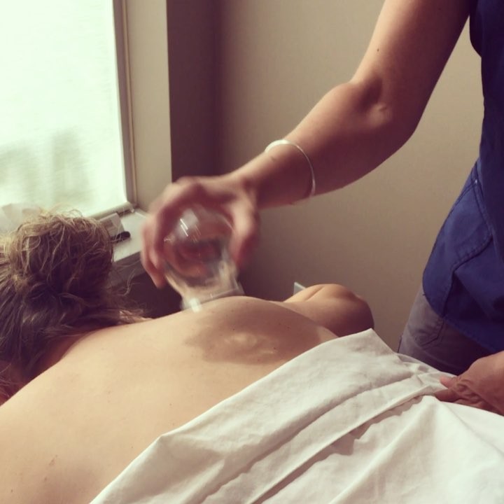 Have you tried cupping? It’s great at encouraging blood flow, relaxing muscles and reducing stress. I use to to help relieve neck pain, back pain, stress, headaches and anxiety!