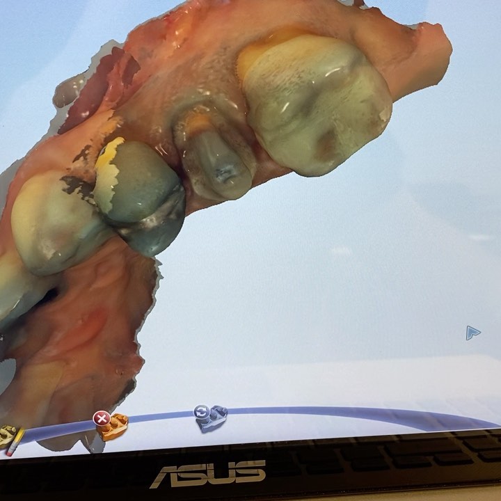 I’m thrilled to be a part of @thecdda in Charleston, March 12-13th. We’ll be scanning and milling restorations in a hands-on, sales-free workshop.
www.thecdda.com #digitaldentistry #dentaleducation #dentallife #dentaldesign