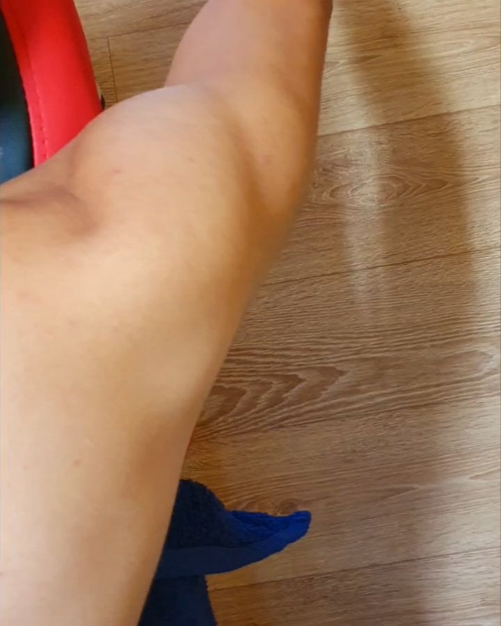 INESTABILIDAD DE HOMBRO
En el siguiente video podemos observar cómo se comporta un hombro inestable al solicitar un movimiento de flexión del hombro al paciente.
En este caso, la propuesta de tratamiento debe centrarse en trabajar de forma activa toda la musculatura del complejo articular del hombro, tanto a nivel de potenciar la musculatura como a nivel de plantear diferentes estrategias que nos ayuden a mejorar el control motor.
Gracias @aleix_nk por dejarme compartir el video, ¡buen trabajo!
#rehabilitación #recuperacion #readaptación #fisioterapia #fisioterapiadeportiva #dolor #hombro #manguitorotador #inestabilidad #articulaciones #musculatura #fuerza #dosrius #mataro #llinarsdelvalles