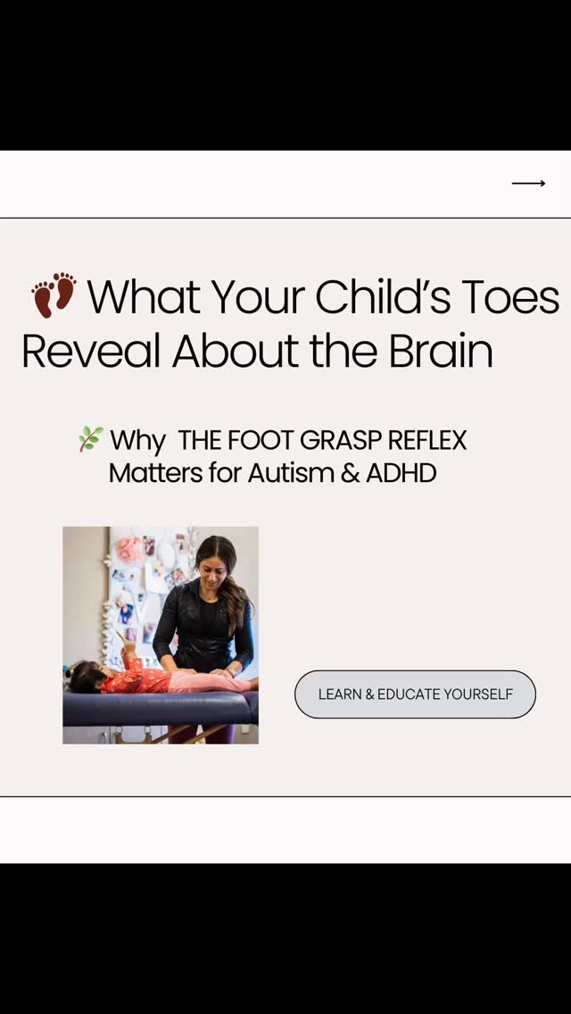 👣 Why Your Child’s Toes Matter 👣
Did you know your baby is born with a reflex in their feet that makes their toes curl when the sole is touched? 🌿 This is called the Foot Grasp Reflex — a normal and important part of early development.
✨ In infancy:
It’s useful for neurological assessment and shows that the nervous system is developing as it should.
⚠️ But if it stays active beyond infancy — or if it reappears later in childhood…
It can signal that the nervous system hasn’t fully matured yet. This may look like:
• 🌀 Poor balance or coordination
• 📚 Learning difficulties
• 💡 Challenges linked to ADHD or ASD
🌍 Why it matters:
Retention or re-emergence of this reflex isn’t just about the feet — it’s about brain connectivity. In autism and ADHD, it often signals uneven development and can contribute to the daily struggles families see.
🔥 The good news:
With the right interventions, these retained reflexes can be integrated — helping kids find more balance, focus, and confidence.
🌸 Book your FREE 30-minute consultation for the Mother Magic™ Integration Program — link in bio!
#MotherMagic #BrainReconnection #PrimitiveReflexes #FootGraspReflex #ReflexIntegration #ChildHealing #ParentHealing #AutismSupport #AutismAwareness #ADHDAwareness #Neurodevelopment #Neuroplasticity #SpecialNeedsParenting #HealingJourney #HolisticParenting #ParentEmpowerment #NervousSystemHealing #TraumaHealing #ChildTherapy #MindBodyHealing #HolisticHealing #ConsciousParenting #NextLevelHealing #RiseAndHeal #HealingFromWithin