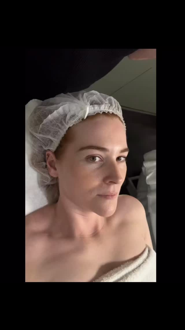 ✨ A rare moment for me… actually being the one pampered on the treatment bed! 💆♀️
Training days with @ultraceuticals are always such a highlight! Connecting with incredible educators and therapists, learning, laughing, and of course getting my glow on. 💆♀️
🇦🇺🌿I choose to partner with this brand because they’re Australian owned, vegan, ethically sourced and powered by seriously high-performance ingredients that deliver results you can truly see and feel. 🐇💎
It’s no wonder my clients can’t get enough of these treatments and products; the results speak for themselves. The transformations I see in clinic every week honestly blow me away. 🤍
And the best part? We’ve got some brand-new treatments and products launching soon… I cannot wait to share them with you! 🚀✨
#hawthornebeautyclinic #ultraceuticalsaustralia #glowingskin