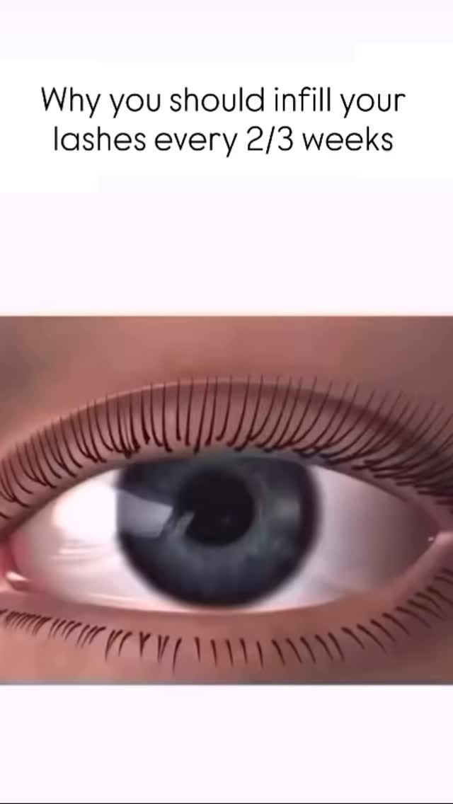 This is why regular lash infills matter! As your natural lashes grow, extensions move with them and if left too long, they can become heavy and cause shedding. Keep your lashes healthy & flawless by booking your infills every 2–3 weeks. 💕
If you decide not to get an infill, you can come in for a safe removal or let them shed naturally. To help them come out faster at home, avoid brushing them, use oil-based products around your eyes, and a little steam can also help loosen the bond.
#LashExtensions #LashInfills #HamiltonLashes #HealthyLashes #LashCare #LashRemoval #lashaddictionnz #hamilton