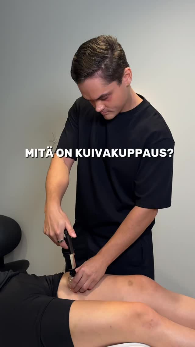 Mitä on Kuivakuppaus?
Kuivakuppaus on perinteinen kehonhoitomenetelmä, jossa ihoon kiinnitetään erityisiä kuppeja alipaineen avulla. Kuppien tehtävänä on vetää ihoa ja sen alla olevia kudoksia ylöspäin, mikä saa aikaan paikallista verenkierron vilkastumista, kuona-aineiden liikkeellelähtöä ja lihasjännityksen lievitystä.
Kuiva kuppakseussa kupit asetetaan iholle luomalla alipaine imupumpulla.
Kupit jätetään paikalleen 5–15 minuutiksi.
Lopuksi kupit poistetaan ja iho hierotaan kevyesti. Hoitoa tehostetaan aktiivisilla ja passiivisilla liikkeillä.
Kuivakuppaus lievittää lihasjännitystä ja kipuja, parantaa verenkiertoa sekä tehostaa aineenvaihduntaa ja imunestekiertoa! Kuivakuppaus on tehokas esimerkiksi vamman aiheuttaman turvotuksen laskemisessa.
Kiinnostuitko? Varaa aikasi Jamille kuivakuppaukseen osoitteesta: naprawealth.fi/ajanvaraus
#kuivakuppaus #kehonhuolto #palautuminen #naprawealth #liikkumisentueksi #helsinki #ruoholahti