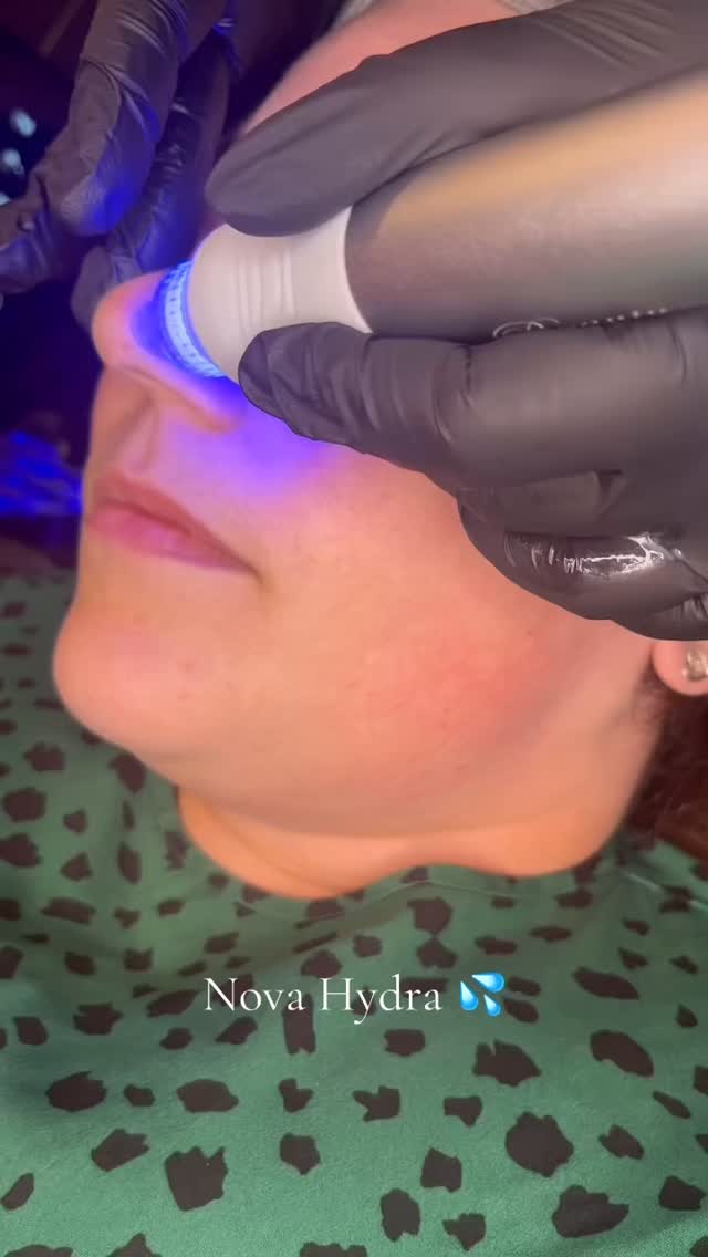 💦Get That Glow Like No Other
Nova Hydra is the ultimate facial system for delivering healthy, radiant skin your clients will love and rebook.
This revolutionary treatment combines five essential technologies in a single session:
💦Cleansing
💦Exfoliation
💦Extraction
💦Deep hydration
💦Antioxidant protection
The result? A refreshed, rejuvenated complexion that keeps clients coming back.
💖For Clinic and Salon Owners
☑️Easy payment plans - no high finance rates
☑️Affordable consumables - more treatments, more profit
☑️A treatment your clients will love
📩Get in touch with us Nova Pellis Aesthetics today to bring the Nova Hydra system into your clinic and start growing your treatment menu and your revenue.
🌐www.novapellisaesthetics.com
💌info@novapellisaesthetics.com
📱0800 009 6397
📱WhatsApp 07497 831533
#novahydra #novapellis #facialdevice #bespokefacial #skinhealth #skinconfidence #training #consumables #clinicowners #salonowners #radiofrequency