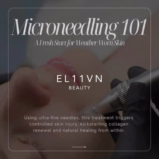 Achieve radiant, smooth skin with microneedling. This powerful treatment stimulates collagen production to improve skin texture, reduce fine lines, and fade scars.
The fall and winter months are the ideal time for microneedling, as cooler weather promotes faster healing and minimizes sun exposure. **For best results, always trust a registered medical professional to perform your treatment.
✨Give your skin the care it deserves this season.
📲 Book now. Link in bio
👩🏼⚕️ Nurse Mel
📍 Burlington, ON. Oakville, ON
🚘 Mobile services now available
.
.
.
.
.
.
.
#Microneedling #SkincareGoals #nursemel #BurlingtonOntario #FlawlessSkin #CollagenBoost #HealthySkin #GlowingSkin #WinterSkinCare #AntiAging #SkinRenewal #BeautyTreatment #SelfCare #RadiantSkin #SkinGlow #BeautyRoutine #AgelessBeauty #SkincareTreatments #MedicalAesthetics #BeautyByProfessionals #oakvilleontario #RejuvenateYourSkin #SkincareCommunity