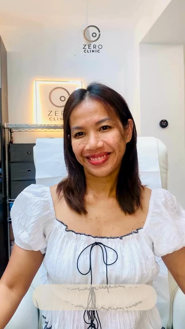 2 weeks review after Anti Wrinkles injection and MesoTox + NCTF 135
เราอาจจะไม่ค่อยรู้สึกหัตการ ที่เรียกว่า mesotox กันมากนัก สันนี้จะถทอโ กาสมาอธิบายให้เข้าใจกันเพิ่มเติม
ข้อดีของ Mesotox + NCTF (การผสมผสาน Botulinum toxin กับ NCTF 135 serum มีหลายอย่างเลยค่ะ เพราะเป็นการรวมข้อดีของทั้งการฉีดโบทูลินัมและการบำรุงผิวลึกในคราวเดียวกัน
1. ลดการทำงานของกล้ามเนื้อระดับตื้น
– ทำให้รูขุมขนเล็กลง ผิวเรียบเนียนขึ้น โดยไม่ทำให้ใบหน้าดูแข็งหรือขยับไม่ได้
2. ผิวกระจ่างใส อิ่มฟู
– สารบำรุงอย่าง NCTF จะช่วยเติมความชุ่มชื้น กระตุ้นการสร้างคอลลาเจน และปรับสมดุลผิว
3. ลดเลือนร่องสิวและผิวไม่เรียบ
– เหมาะกับผู้ที่มีรอยหลุมสิวตื้น ๆ หรือผิวไม่เรียบเสมอกัน
4. ผลลัพธ์ดูเป็นธรรมชาติ
– Mesotox จะเน้นความละเอียดอ่อนของผิว ทำให้ได้ลุคสดใส ผิวสุขภาพดี
5. ฟื้นฟูผิวในระยะสั้นและยาว
– เห็นผลผิวใส เนียนขึ้นใน 14 วัน และยังช่วยเรื่องโครงสร้างผิวในระยะยาวด้วย
⸻
สรุปคือ 👉 Mesotox = หน้าใส + ผิวฟู + ลดรูขุมขน + เรียบเนียนแบบเป็นธรรมชาติ
เหมาะกับคนที่อยากได้ glow skin effect ไม่ใช่แค่ “ริ้วรอยหาย” แต่คือภาพรวมผิวที่ดูดีขึ้นค่ะ 💙
#ZeroClinic #ZeroClinicUK #ZeroClinicLeeds #Mesotox #GlowSkin #BeautyWithZero
#GlassSkin #HealthySkin #SkinBooster #AntiAging #RadiantSkin #YouthfulGlow
#คลินิกคนไทยในอังกฤษ #พยาบาลไทยในอังกฤษ #หน้าใส #ผิวโกลว์
#Leeds #UKBeautyClinic #ThaiClinicUK #nctf135ha #fillmednctf135ha