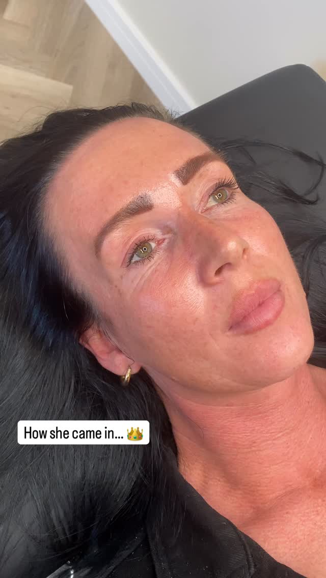 Transformation Alert 🚨😍
I absolutely loved doing these brows on this Queen. 👑
🎥 Clip 1: client’s own brow makeup
🎥 Clip 2: makeup washed off & bare brows
🎥 Clip 3: finished result: lamination + hybrid dye ✨
This transformation is about more than colour 💡
It’s about:
💛 Mapping a shape that really suits the face
💛 Choosing the right colour intensity
we used a hybrid dye mix of black + dark brown for a long-lasting, rich result
💛 Lifting, softening, and smoothing every hair for a flawless finish
💛 Working with your client’s preferences while keeping brows healthy 🌿
Before you finish any brow, ask yourself:
❓ Is the tint the right shade for their brows and skin tone?
❓ Is the shape balanced and flattering for their face?
❓ Are all hairs processed correctly… not under, not over?
❓ Does the brow look soft, lifted, and polished from root to tip?
👀 Love this transformation as much as I do?
Then make sure to hit LIKE ❤️ and give me a follow @lashandbrowworkshop
#brows #browlamination #hybriddye #browtransformation #browartist #browtraining #browtips #broweducation #laminationtips #lashandbrow #londonbrows #devonbrows #kingsteigntonbrows #newtonabbotbrows #browgoals #browtutorial