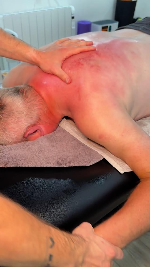 🚴 Shoulder pain after a fall? Here’s a real client story.
This client came to us after a bike accident with severe shoulder pain and stiffness. Before treatment, he could only lift his arm to 45°.
✅ After just one session of sports massage + acupuncture, he reached 120°.
✅ After 3 sessions, he had a 90% improvement and was back at work.
✅ He’s still coming for maintenance to get back to full strength.
Sports massage, acupuncture, and the right rehab can help speed up recovery and get you moving again. 💪
📩 If shoulder pain is holding you back, DM us or book your session today.
#Liverpool
#Aintree
#Wellness
#Recovery
#Massage
#Physiotherapy
#Acupuncture
#Shoulder
#Sports
#Fitness