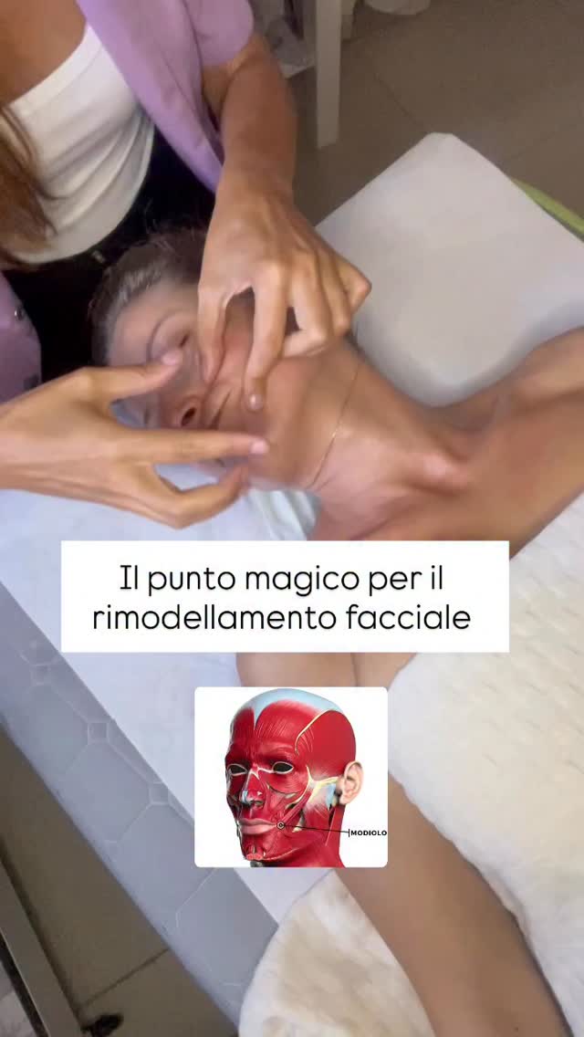 Il modiolo non รจ un singolo muscolo, ma una struttura fibromuscolare complessa situata ai lati della bocca, dove convergono molti muscoli facciali. Tra i muscoli che vi contribuiscono ci sono il buccinatore, lโorbicolare delle labbra, il risorio e il depressore dellโangolo della bocca. Il modiolo รจ una zona densa e mobile, essenziale per la mimica facciale, e forma un punto di riferimento anatomico.
Nella mia Accademia imparerai a trattare questo punto di intersezione fondamentale per migliorare le :
Rughe naso labiali
Rughe della marionetta
Rughe del contorno labbra
Zigomo
Per la formazione di gruppo rimane solo un posto disponibile 30 novembre 1 dicembre Roma ultimo evento dellโanno.
Corso professionale disponibile On line e in forma personalizzata.
Scrivi Professionale ed ricevere in formazioni o link in bio @annaluisacorvaglia_skingym
#corsoviso #ringiovanimentoviso #riflessologiafaccialerimodellante #massaggioviso #skingym#facialist #visagista