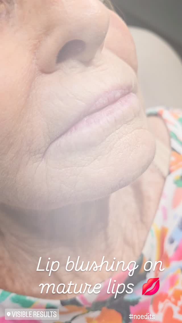 Mature lips can benefit from lip blushing, too! 🤍
It's a great way to regain lost lip symmetry and color with age ✨️
Can't wait to see these beauties healed!!
Ready to bring your lips to life?! Have questions or ready to make your appointment? You can follow the link in bio, DM, or Text 843-499-4357 ...
#lipblush #watercolorlips #lipblushtattoo #lipgoals #lipblushing #lips #browslipseyes #lipblushtraining #charlestonlips #waterproof #microbladingcharleston #cosmetictattoo #permanentmakeup #smudgeproof #permanentmakeupspecialist SouthCarolina #Charleston #Mtpleasant #Summervillesc #Ladson #Jamesisland #Johnsisland #Kiawah #Myrtlebeach #PawleysIsland