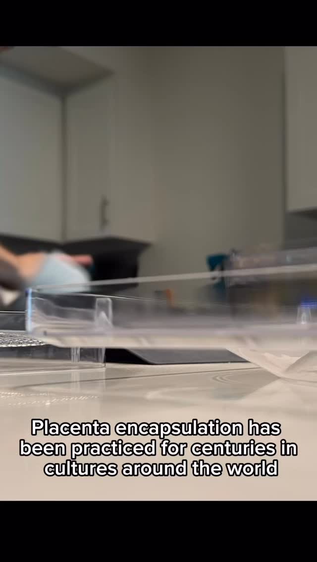 🌿 Placenta Encapsulation: What You Should Know
Why do it?
Placenta encapsulation is the process of drying, grinding, and encapsulating the placenta after birth. It’s believed to help mothers recover more smoothly postpartum.
Reported Benefits
✨ Restores iron and essential nutrients lost in childbirth
✨ Boosts energy during postpartum recovery
✨ Stabilizes mood and may reduce “baby blues”
✨ Supports lactation and milk supply
✨ Promotes faster uterine healing
✨ Provides a sense of ritual and connection
Traditional Chinese Medicine (TCM) View
In TCM, placenta is called zǐ hé chē (紫河车). For centuries, it has been used to tonify Qi and Blood, nourish Kidney essence, and restore vitality after childbirth or serious illness.
Western Medicine Findings
• Studies (e.g., Gryder et al., Am J Obstet Gynecol, 2017) show placenta capsules can modestly improve iron levels.
• Nutritional analysis reveals small amounts of iron, B vitamins, zinc, selenium, and hormones like estrogen and progesterone.
• Evidence on mood and lactation is limited, but many women anecdotally report benefits.
Important Note
⚠️ Safety depends on proper preparation: dehydration at ≥160°F, clean handling, and proper storage.
⚠️ Major health organizations (like the CDC) caution that placenta encapsulation is not risk-free, due to potential bacterial contamination.
Bottom Line
Many mothers find placenta encapsulation beneficial for recovery, energy, and emotional balance, though science hasn’t confirmed all claims. If you’re considering it, weigh both the traditional wisdom and the modern evidence — and always prioritize safety.
