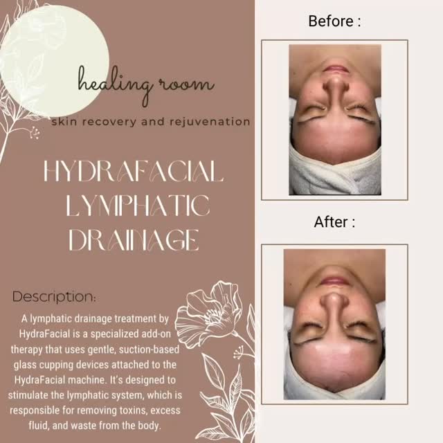 It’s about the #lymph #lymphaticmassage #lymphaticdrainagefacialmassage #hydrafacial #greatskin #goodskin #skinlove