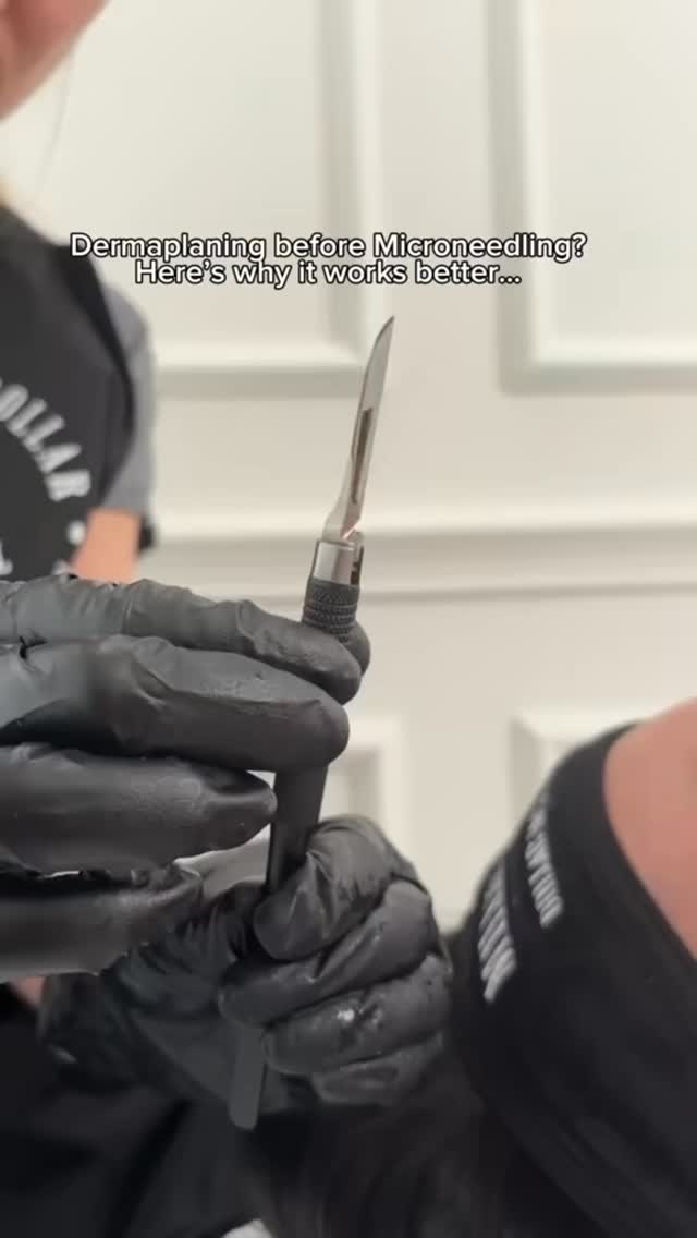 ✨ Smooth first, glow deeper! ✨
Dermaplaning removes peach fuzz + dead skin so microneedling can…..
⬆️ Increase product penetration into the skin
🔗 Boosting collagen and elastin
🌟 Give your skin that extra wow factor.
🤔Think of it like priming a canvas before painting—better prep, better results! 🤩
#Dermaplaning #Microneedling #GlassSkin #SkinPrep #CollagenBoost #DewySkin #Exfoliation #SkinRenewal #GlowFromWithin #SkinTreatment #FacialCare #SelfCareGlow
