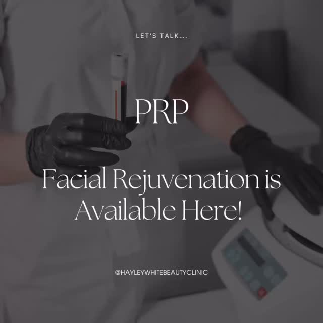 Available here @hayleywhite_beautyclinic #prpmicroneedling #vampirefacial #rejuvenation #facials