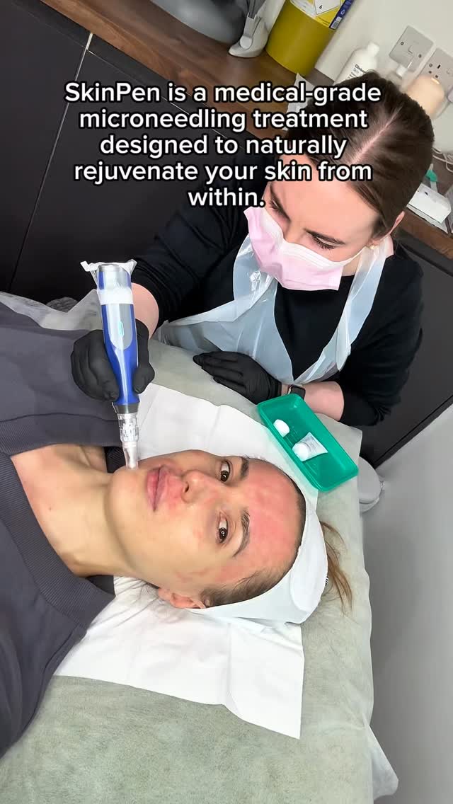 💖 Book your SkinPen session today and step into your skin’s next chapter of radiance. #SkinPen #MicroneedlingCambridge #SkinPenTreatment #CollagenBoost #SkinRejuvenation #GlowingSkin #RadiantComplexion #SkinConfidence #SmoothSkin #YouthfulGlow