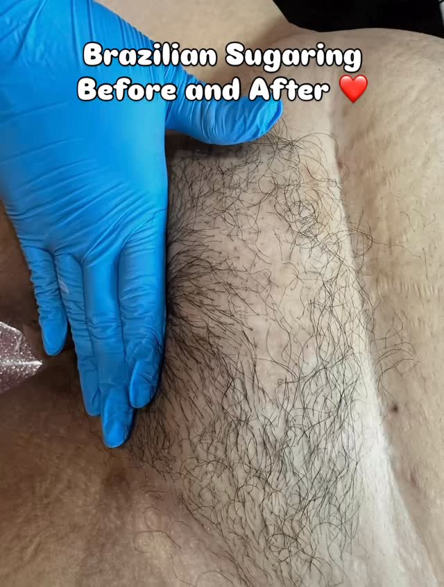 At Glam Body Sugaring Boutique, we believe every body is beautiful, worthy, and welcome. 💕
This before-and-after is a real client — no filters, no judgment, just smooth, glowing skin and trust. Our space is all about comfort, compassion, and confidence for every body type.
Sugaring is the gentlest form of hair removal — organic, clean, and ideal for sensitive skin. 🍯✨ Whether you’re curvy, petite, first-time, or a regular, our goal is to make you feel safe, seen, and stunning from start to finish.
You deserve to feel confident in your skin — we just help you shine a little brighter. ✨
📍 Glendale, Queens
#GlamBodySugaringBoutique #QueensEsthetician #BrazilianSugaring #BodyPositivity #CurvyGirlsWelcome #SensitiveSkinCare #OrganicSugaring #RealResults #GlendaleQueen