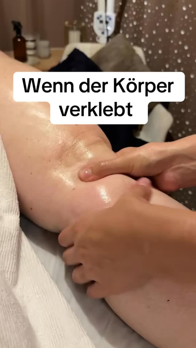 🔹 Was ist Maderotherapie?
• Eine manuelle Behandlungsmethode mit speziellen Holzwerkzeugen (Rollen, Schaber, Cups).
• Ursprung: Südamerika, heute v. a. in Wellness und Physiotherapie beliebt.
• Ziel: Faszien lösen, Durchblutung anregen, Gewebe entspannen.
⸻
🔹 Wirkung auf die Faszien
• Mechanischer Druck und Rollbewegungen stimulieren das Bindegewebe.
• Dadurch kann sich die Gleitfähigkeit der Faszien verbessern.
• Löst Spannungen, reduziert „Verklebungen“ und unterstützt die Lymphzirkulation.
• Wird oft auch für Cellulite-Behandlungen und Muskelregeneration eingesetzt.
⸻
🔹 Ablauf einer Behandlung
1. Mit Öl wird die Haut vorbereitet.
2. Unterschiedliche Holztools (Rollen, Glocken, Pilze) werden über das Gewebe bewegt.
3. Der Druck reicht von angenehm bis intensiv – ähnlich wie bei einer tiefen Bindegewebsmassage.
4. Eine Sitzung dauert meist 30–60 Minuten.
⸻
🔹 Vorteile
• Natürliche Methode ohne Geräte
• Fördert Durchblutung und Stoffwechsel
• Kann Muskeln und Faszien lockern
• Viele empfinden es als entspannend
⸻
🔹 Mögliche Grenzen / Hinweise
• Nicht bei akuten Entzündungen, frischen Verletzungen, Krampfadern oder Thrombosen
• Kann zu Beginn Muskelkater-ähnliche Schmerzen oder blaue Flecken verursachen
• Wirkung hängt stark von Regelmäßigkeit und Kombination mit Bewegung & Ernährung ab
#lipödem #madero #maderotherapie #münchen #lymphaticmassage #massage #wassereinlagerungen