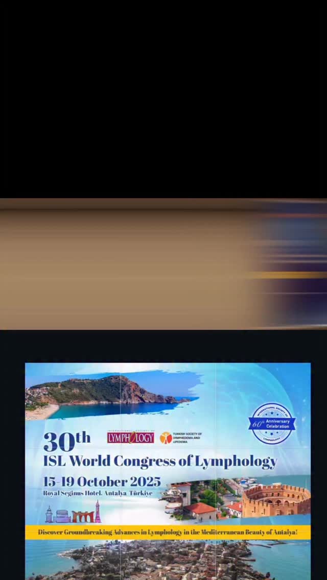 Dünya Lenfödem Kongresi / World Congress of Lymphology
Lenfödem mikrocerrahisi ve tedavisi
Lenfödem Cerrahisi
Lenfödem Hastalığı erken dönemlerden başlayarak cerrahi ile tedavi edilmesi gereken bir durumdur.
Lymphedema is a condition that requires surgical treatment starting from its early stages.
☎️+90 544 971 4801
Doçent Dr. TAHSİN OĞUZ ACARTÜRK
Plastik, Rekonstrüktif ve Estetik Cerrahi
@dr.oguzacarturk
#Lenfödem #filhastalığı #fizyoterapi #fizyoterapist #lipödem #lipedema #lymphedema #lva #plastikcerrahi #estetikcerrahi #izmir #istanbul #ankara #memekanseri #liposuction #mikrocerrahi #microsurgery #lenfödemcerrahisi #lenfödemterapisi #fiziktedaviverehabilitasyon