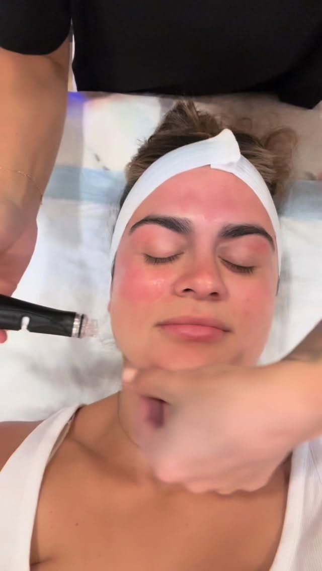 Wedding prep for everyone’s fav BFF 💐
Hydrafacial ✔️
Brows✔️
Dermaplane✔️
Bridesmaid duties include providing emotional support to the bride, assisting with pre-wedding events like the bachelorette party and bridal shower, helping with wedding planning tasks, and fulfilling specific roles on the wedding day!
😅Bridesmaids need LOVE too.
#weddingprep#syracusewedding#bridesmaid#baldwinsvilleny
#syracusedayspa#hydrafacial