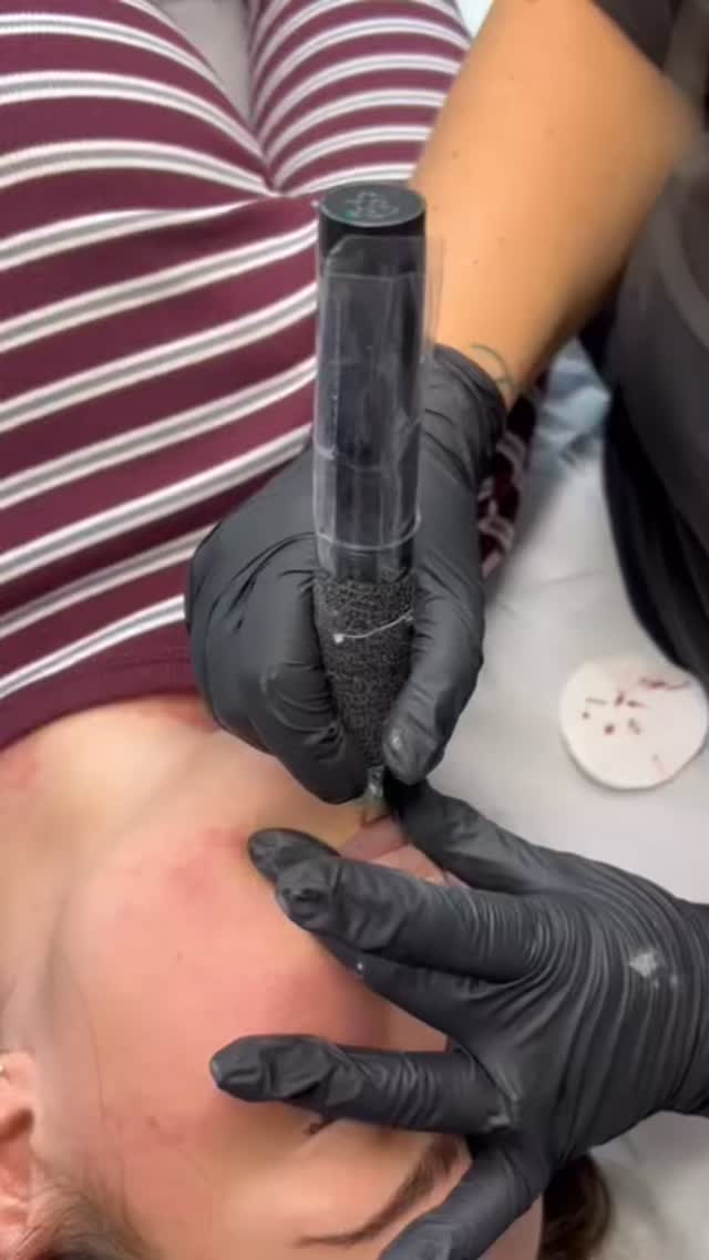 Taking my time to get that perfect outline for lip blush!
Absolutely obsessed with my new venture of PMU I’m enjoying every single minute of it and go into my own little world.
The key is keeping your clients comfortable and our clients barely feel anything 🥰💕💕
#huntly #aberdeenshire #aberdeen #skinclinic #banff #insch #elgin #spmu #spmulips #spmubrows #spmuartist #spmubrows❤️ #lipblush #lipblushing #lipblushtattoo #lipblushuk #aestheticpractitioner