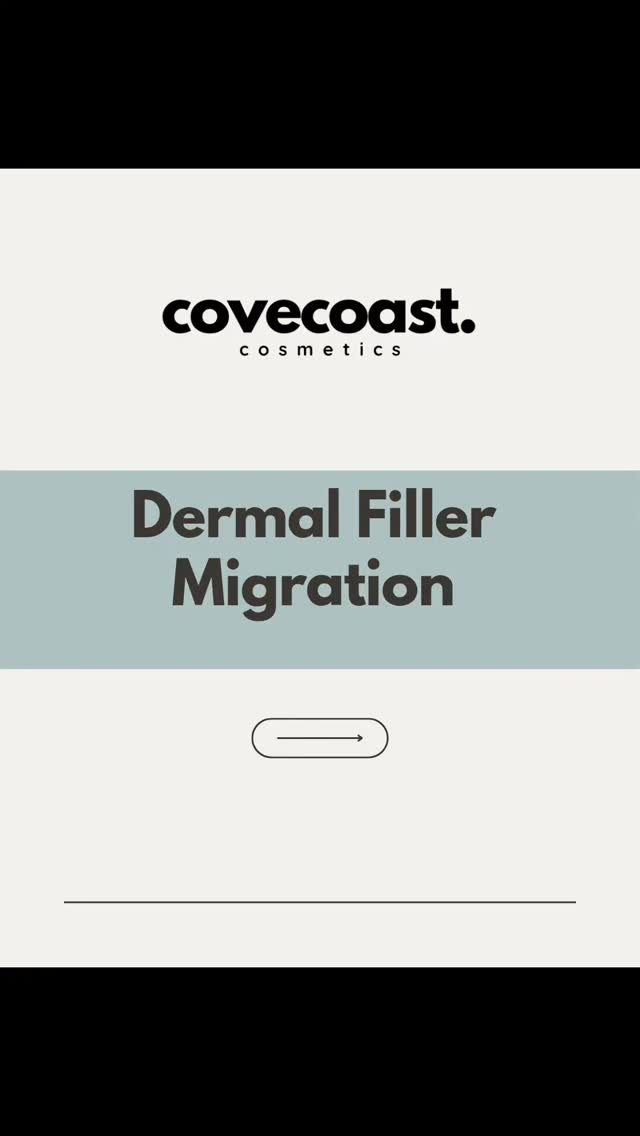 📚
Educational post - Dermal Filller migration
Migration can happen for various reasons, some of which can include the following:
✔️Years of filler on top of old filler
✔️Using cheap fillers
✔️Not following aftercare advice
✔️Having treatment when you're ill/run down
✔️Having treatment to soon after a recent illness
✔️Administering to much filler in one treatment
✔️Filler naturally breaks down over time, and in some cases, pockets of migration can form during this process
⚠️ It's important to note that every case should be assessed on an individual basis at a face-to-face consultation held with a registered prescriber.
If you have concerns regarding filler migration, get in touch to book a free consultation 👩🏼⚕️
#