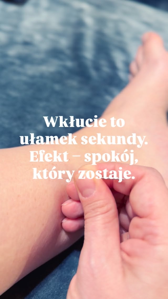 👉 Jeśli boisz się igły – to normalne.
Ale wiesz co? Ten moment trwa krócej niż mrugnięcie okiem. 👁️
A po nim przychodzi ciepło, odprężenie i poczucie, że ciało wreszcie odpuszcza.
Zaopiekuj się sobą w Bertha Holistic. 🌸