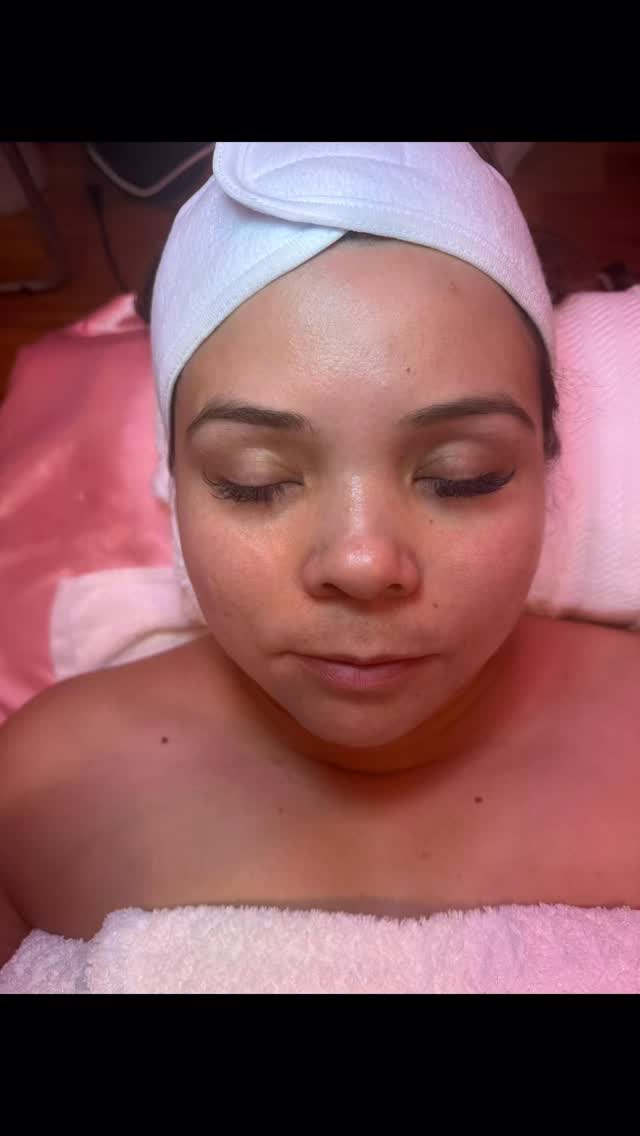 Her transformation results after her “green sea peel” her face is glowing 🌟 book your green sea peel what better time then now it’s peel season 👻