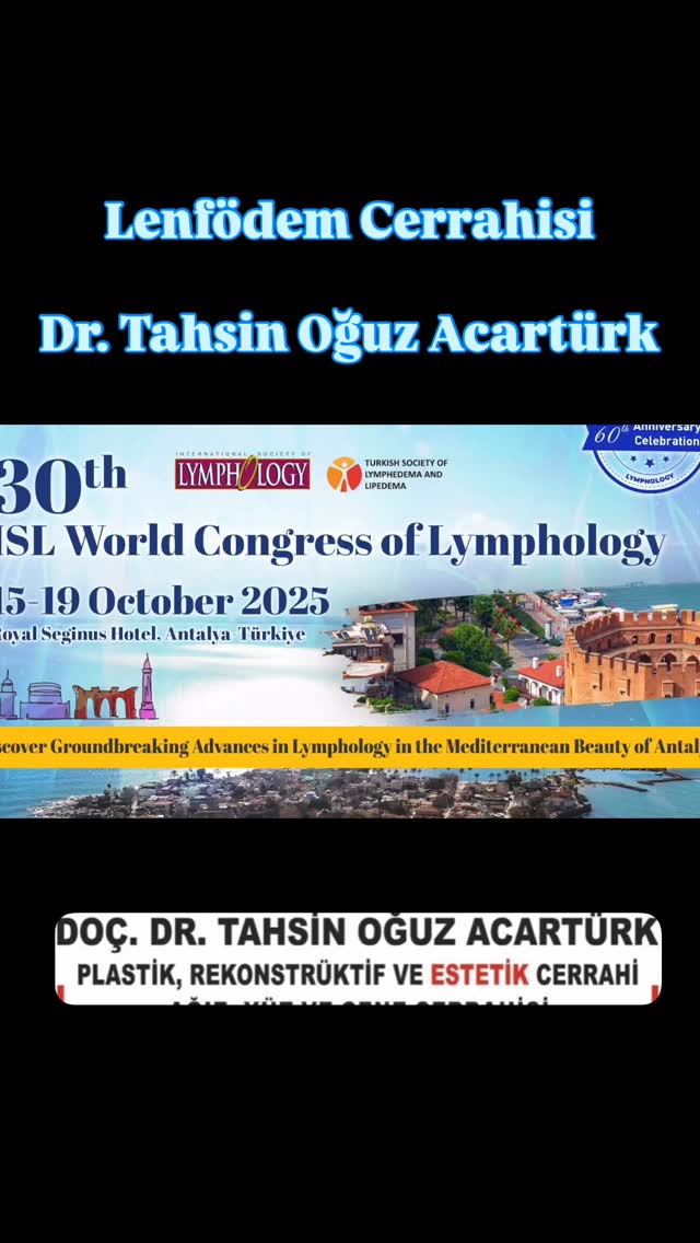 Dünya Lenfödem Kongresi / World Congress of Lymphology
Lenfödem mikrocerrahisi ve tedavisi
Lenfödem Cerrahisi
Lenfödem Hastalığı erken dönemlerden başlayarak cerrahi ile tedavi edilmesi gereken bir durumdur.
Lymphedema is a condition that requires surgical treatment starting from its early stages.
☎️+90 544 971 4801
Doçent Dr. TAHSİN OĞUZ ACARTÜRK
Plastik, Rekonstrüktif ve Estetik Cerrahi
@dr.oguzacarturk
#Lenfödem #filhastalığı #fizyoterapi #fizyoterapist #lipödem #lipedema #lymphedema #lva #plastikcerrahi #estetikcerrahi #izmir #istanbul #ankara #memekanseri #liposuction #mikrocerrahi #microsurgery #lenfödemcerrahisi #lenfödemterapisi #fiziktedaviverehabilitasyon