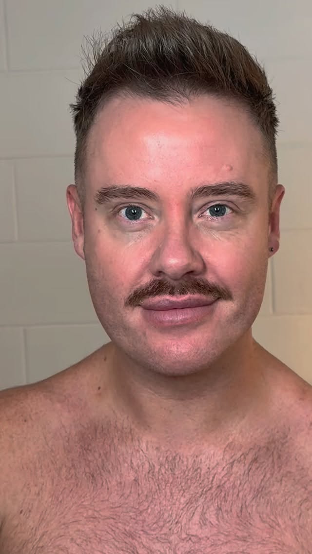 Lunch time peel… at dinner time! 🕒
We had Luke in with us last week for a Pro Alpha Peel, loads of craic from start to finish, and just look at that glow at the end 😍✨
This treatment works to resurface, smooth, and brighten the skin, giving that fresh, healthy radiance everyone loves.