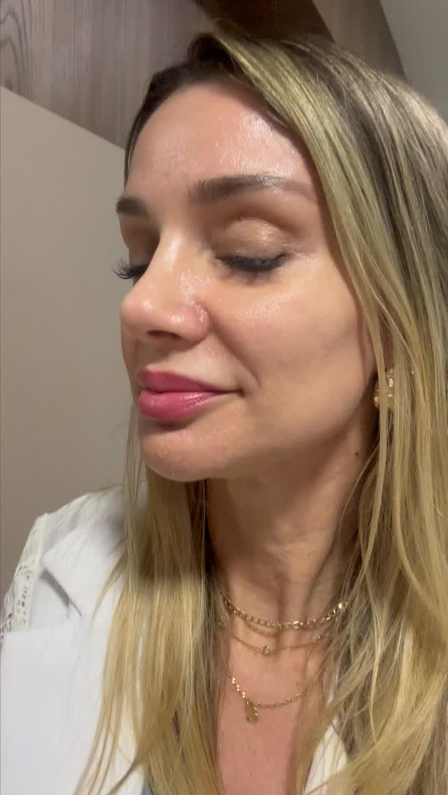 Combinação Avançada: Regeneração, Hidratação Multinível e Proteção Celular
A sinergia entre PureGene PDRN, HyaluPure 10X e Ectoin Natural entrega resultados visíveis em poucas horas, com melhora de viço, textura e hidratação já na primeira aplicação.
Essa formulação cosmecêutica de alta performance atua em:
• Regeneração tecidual e bioestimulação dérmica
• Hidratação tridimensional com efeito preenchedor imediato
• Redução de rugas finas e melhora da elasticidade
• Uniformização do tom e controle de inflamação
• Recuperação da barreira cutânea
• Proteção celular contra a luz UV, luz azul e poluição global.
Ativos e Funções:
• PureGene PDRN – estimula colágeno I e III, reativa fibroblastos e promove reparação do DNA, com melhora de textura em 12–24h.
• HyaluPure 10X – combina 10 pesos moleculares de ácidos hialurônicos, promove hidratação imediata, formação de filme protetor e restauração da função barreira.
• Ectoin Natural – extremólito celular que protege contra estresse oxidativo, reduz TEWL (perda de água transepidérmica), inflamação, melhora elasticidade e luminosidade.
Dúvidas Frequentes:
• Quando aparecem os primeiros resultados?
Em poucas horas, com intensificação perceptível entre 3 e 7 dias.
• É indicada para recuperação rápida da pele?
Sim — ideal para peles fragilizadas, desvitalizadas ou pós-procedimento.
• Formatos ideais:
Séruns noturnos, boosters calmantes e máscaras hidratantes de recuperação intensiva.
Fale conosco Tel/Wpp: (51) 3398-3637
#PureKemika #BioativosDeAltaPerformance #puregenepdrn #HyaluPure10X #EctoinNatural #Skincare #CosméticaAvançada #PeleSaudável #Dermocosmético #glassskin #bitop_ag