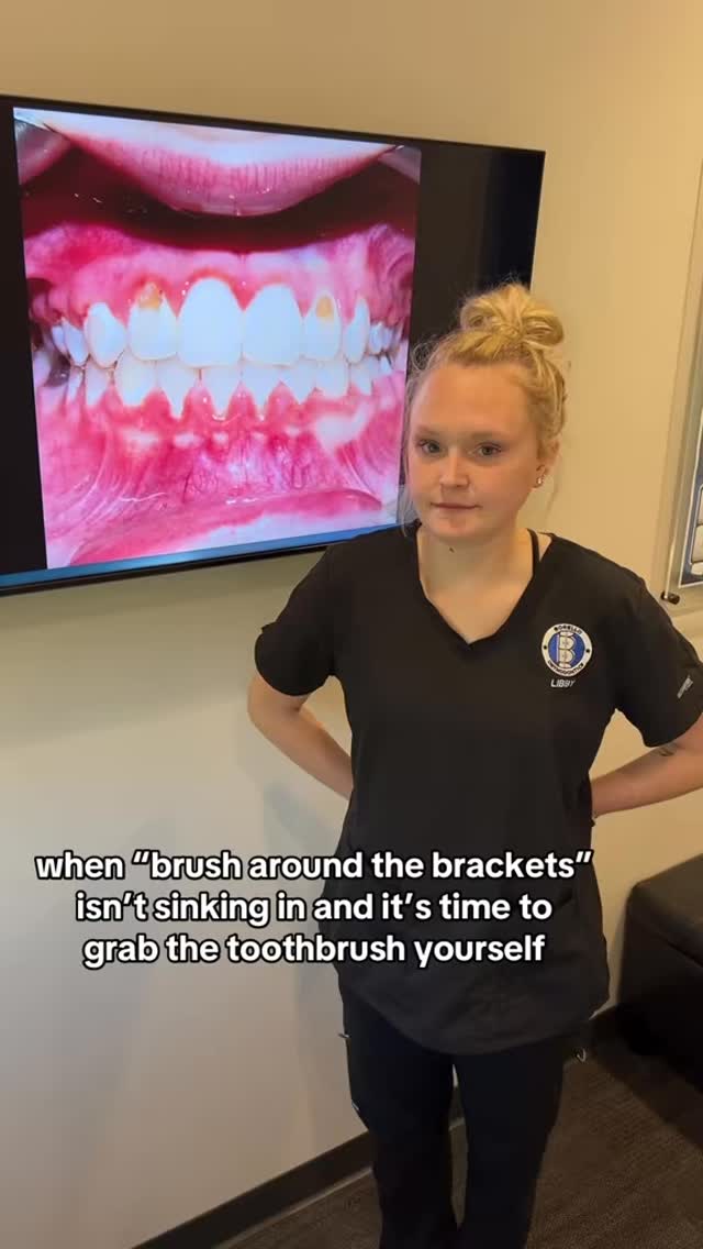 We can only talk about it so much, sometimes we have to grab the toothbrush and show our patients how it’s done! 😂
#bracestips #braces #braceslife #orthodontist #brushingteeth