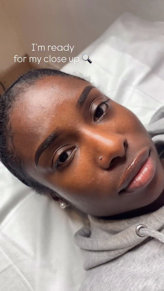 How gorgeous ๐
๐๐๐๐๐: ยฃ300
๐๐๐๐๐๐๐๐๐: Ombrรฉ brows
๐๐๐๐๐๐๐๐: iabrows.com/booking
๐๐๐๐๐: up to 5 years. Touch up may be required.
๐Spread the cost with Clearpay!
๐ธGET 15% OFF WHEN YOU SUBSCRIBE TO MY MAILING LIST ๐
๐๐๐๐๐๐๐๐๐๐๐ ๐๐๐๐๐๐๐๐: 3 hours
๐๐๐๐๐๐๐๐: South London, SE9 6SF
๐๐๐๐๐๐๐๐:iabrows.com/training
#ombrebrows #ombrebrowslondon #pmuartist #microblading #pmubrows