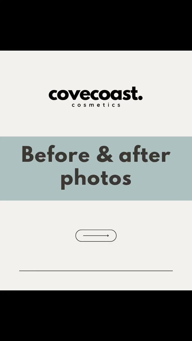 📚Educational post 📚
Ever wondered why you don't see instagram full of before and afters ➡️
#covecoastcosmetics #pooleaesthetics #poolemicroneedling poole
