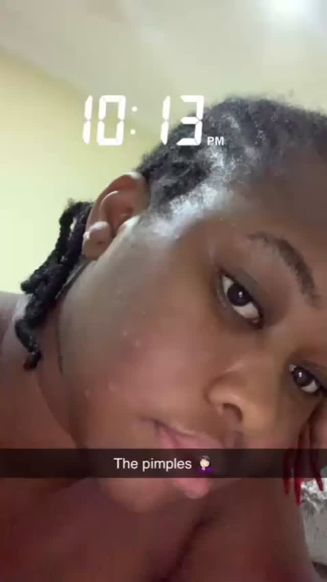 LuxeAura starter kit combines powerful ingredients like azelic acid, bakuchiol, centella asiatica and many others, these work hand in hand to combat blemishes, redness and hyperpigmentation, you wil only know if you try.. visit www.LuxeAuraglow.com to shop yours.. or contact 0546094607 if you are in Ghana