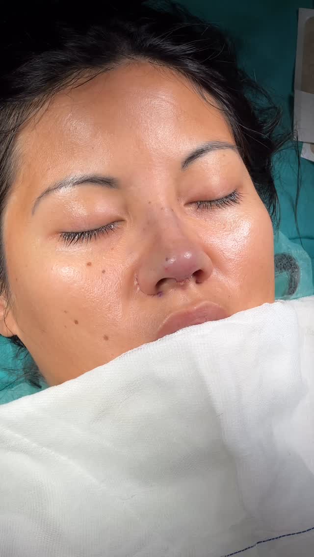 when i finish the operation⭐️⭐️