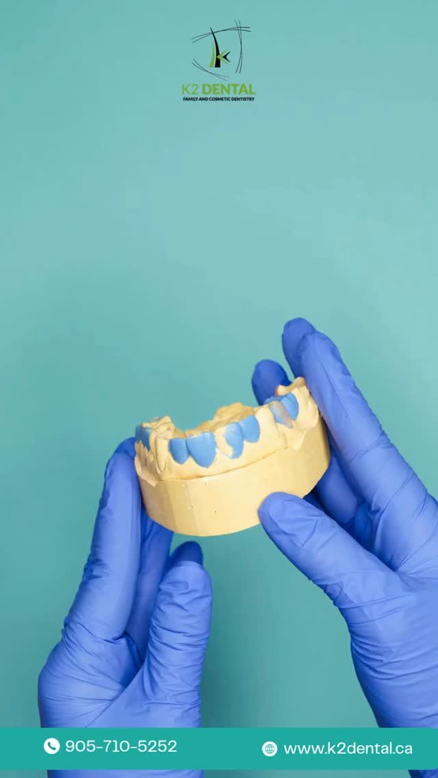 🔷At K2 Dental, we believe your oral health is deeply connected to your overall well-being.
Our holistic approach goes beyond just treating teeth — we focus on the balance between your mouth, body, and mind. From preventive care and nutrition guidance to gentle treatments designed for long-term health, every visit is a step toward a healthier, happier you. 💙
✨ Because a beautiful smile starts from within.
📞 Contact us: 905-710-5252
🌐 Visit: www.k2dental.ca
#K2Dental #HolisticDentistry #HealthySmile #OralWellness #DentalCare #WholeBodyHealth